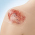 Cuticell Contact Silicone Wound Contact Layer Dressing 3 x 4 Inch Sterile