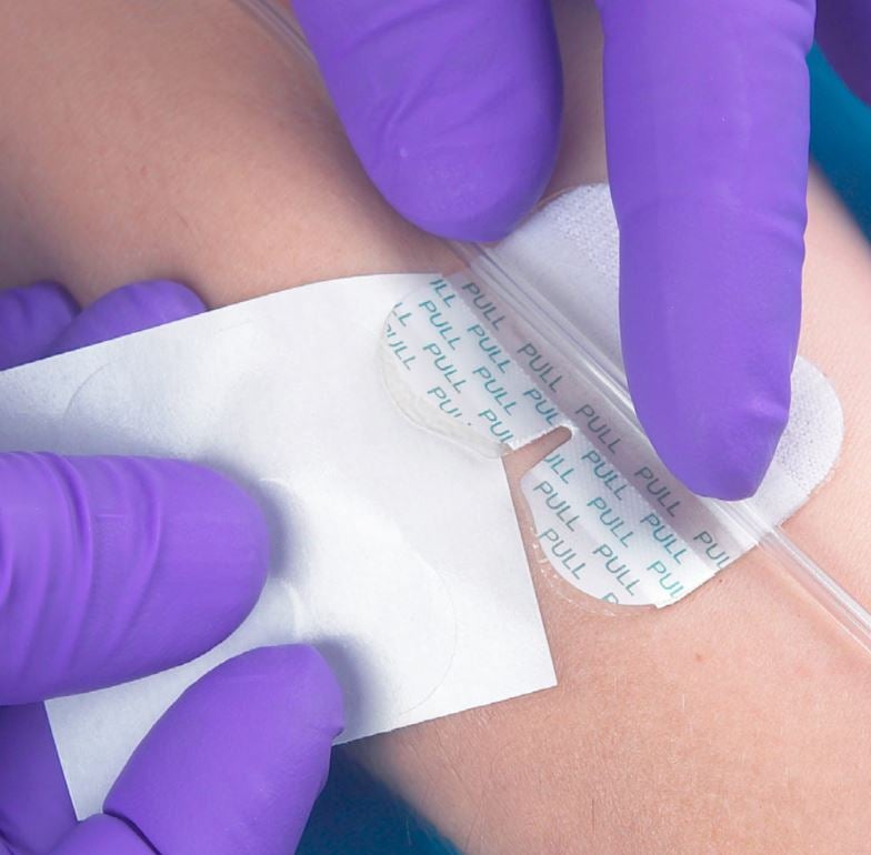 TIDI Grip-Lok Hydrocolloid Gastric Securement Device