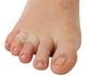 Visco-GEL Little ToeBuddy Toe Spacer - One Size Fits Most