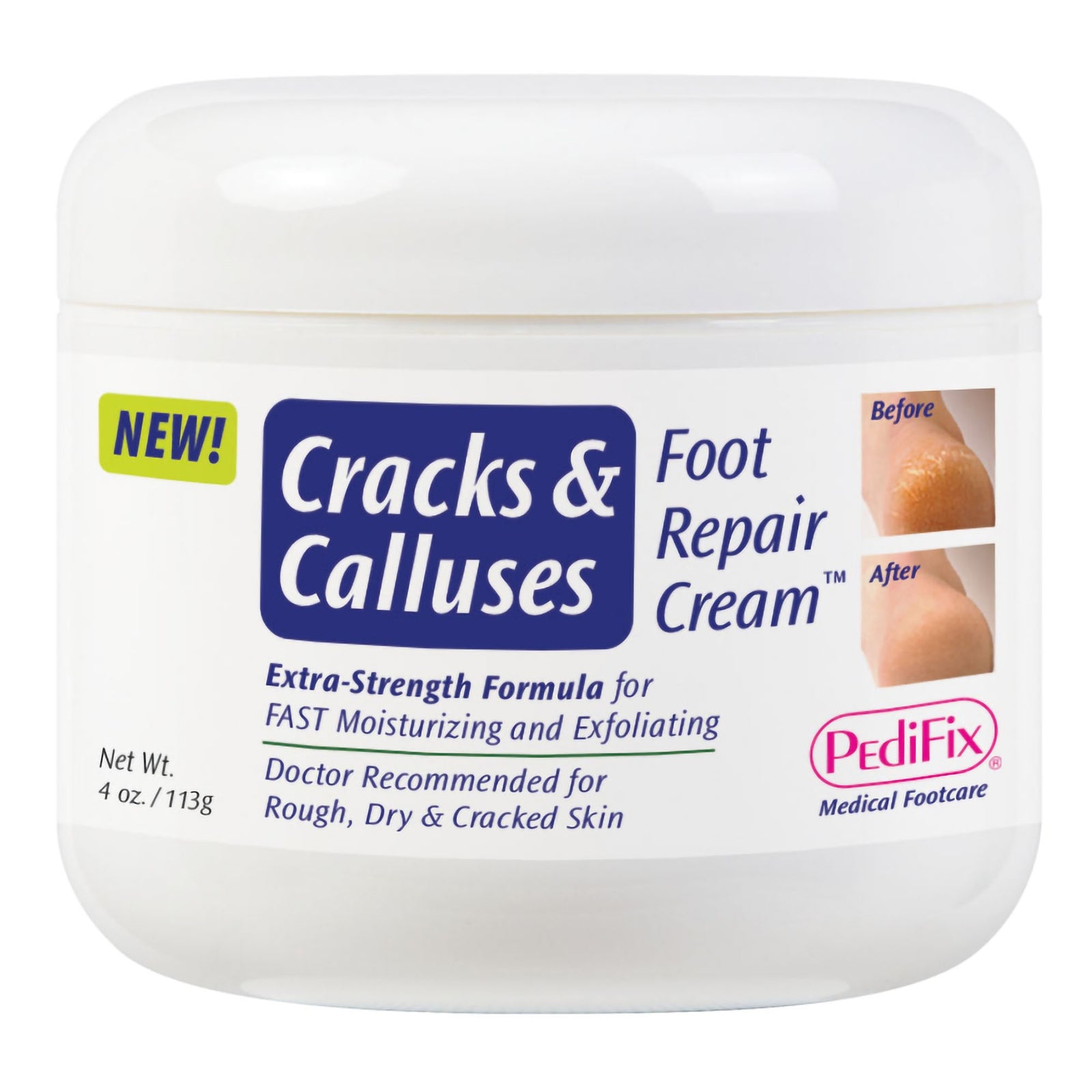 PediFix Foot Moisturizer for Cracks & Calluses 4 oz