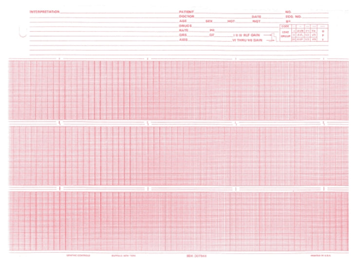 Spacelabs ECG Recording Chart Paper