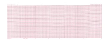 Spacelabs ECG Recording Chart Paper