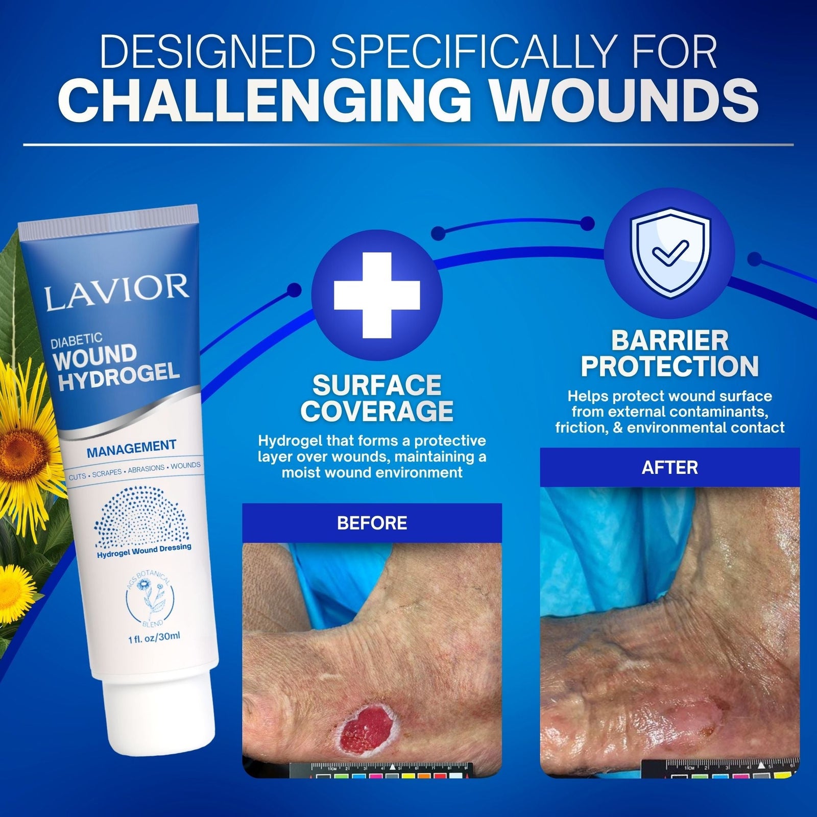Lavior Diabetic Wound Therapy Hydrogel, 1 oz