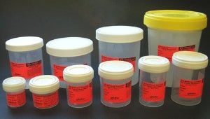 SP® Prefilled Formalin Containers