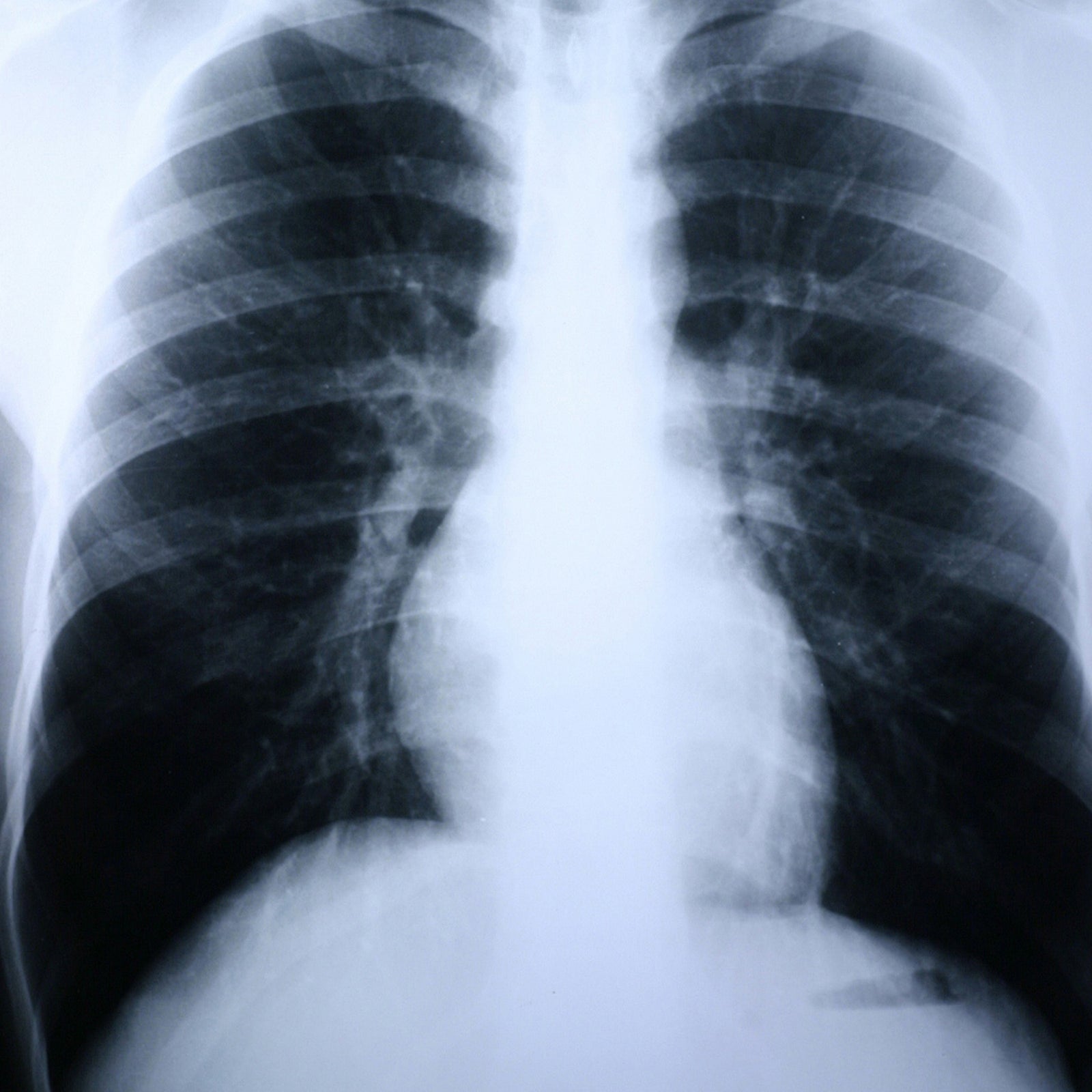 Clear Choice Performance Medical X-Ray Film 8 x 10 Inch