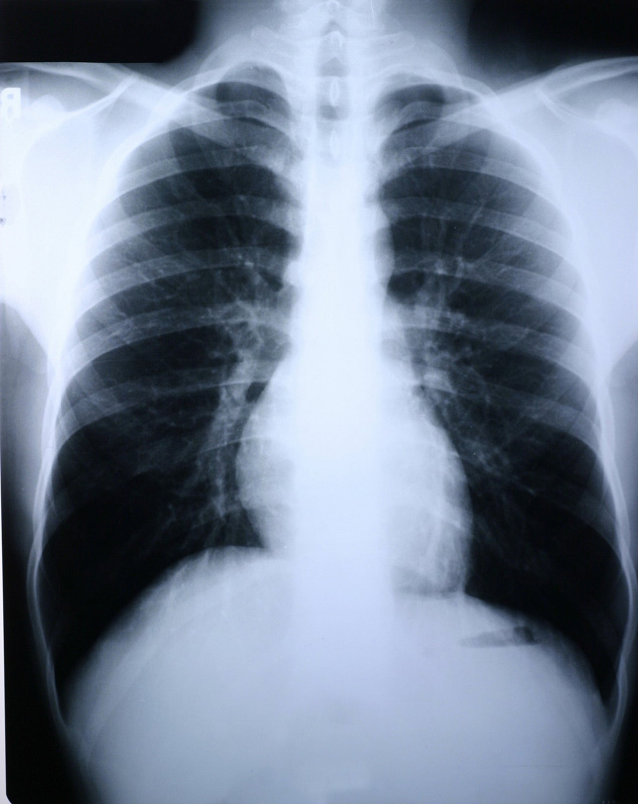 McKesson High-Speed Blue X-Ray Film, 10 x 12