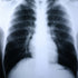 McKesson MedSurg X-Ray Film