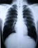 McKesson MedSurg X-Ray Film