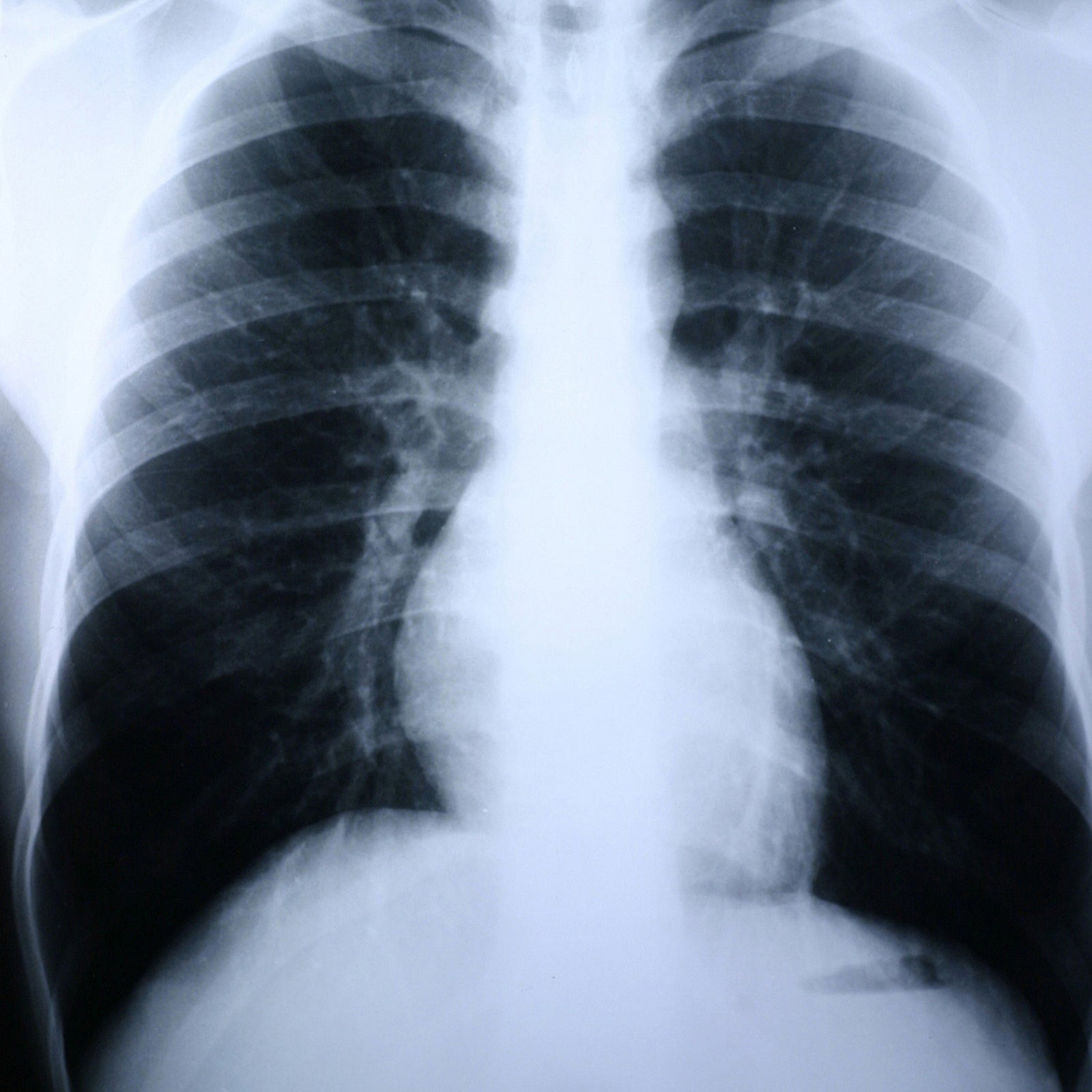 McKesson MedSurg X-Ray Film