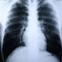 McKesson MedSurg X-Ray Film