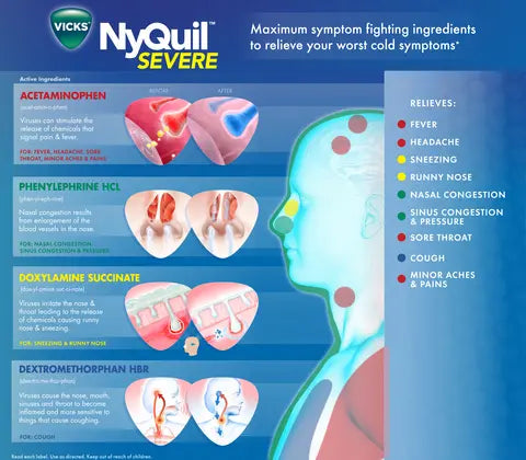 NyQuil Severe, Cold & Flu - Single Pack Blister