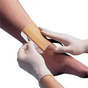 Smith and Nephew Replicare Hydrocolloid Dressing