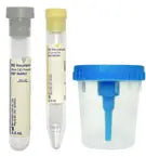 BD Vacutainer Urine Collection Kit, Sterile