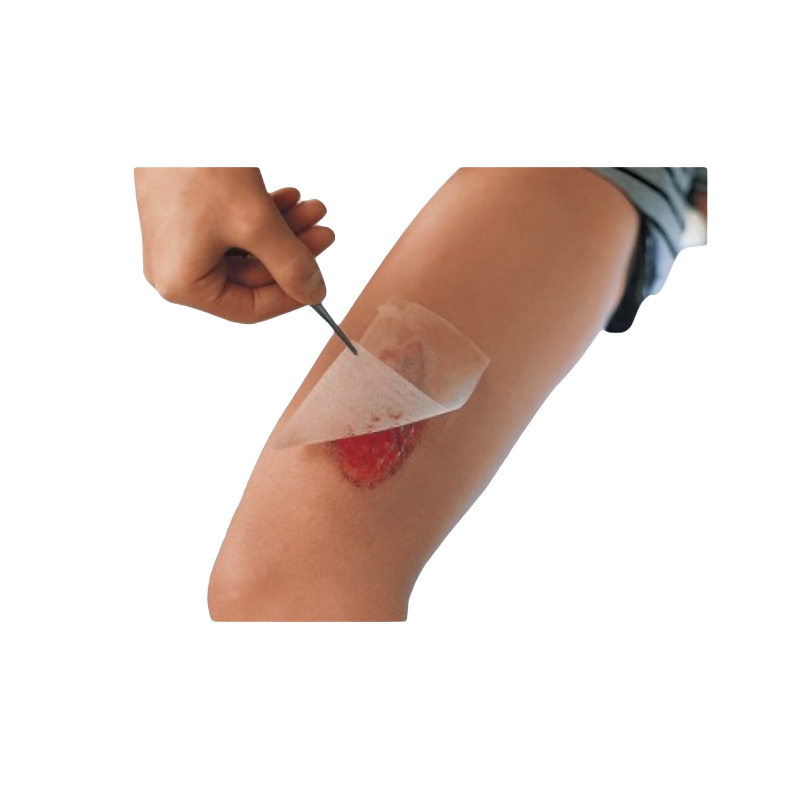 Cuticerin Oil Emulsion Impregnated Dressing