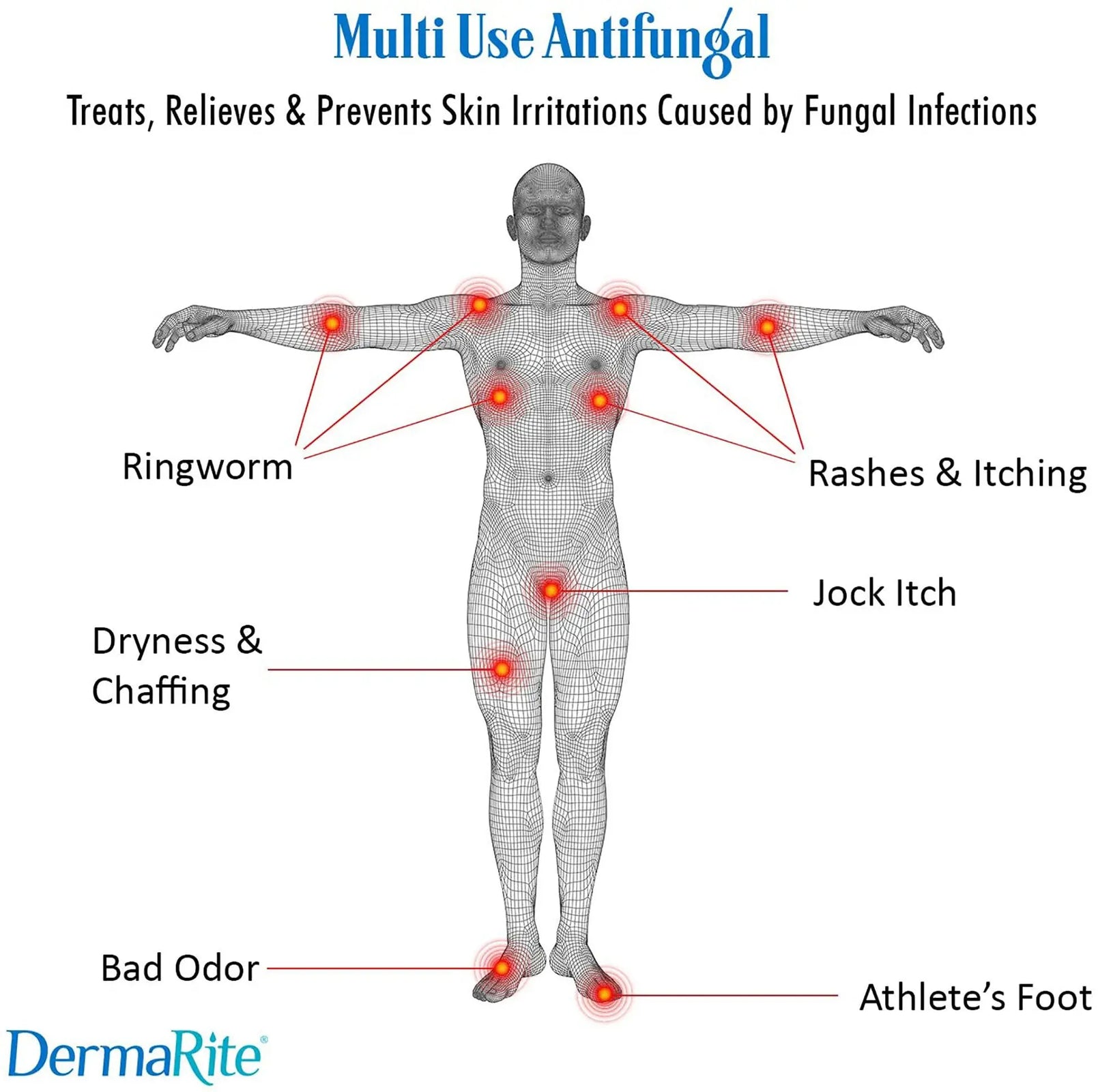 DermaRite DermaFungal Antifungal Cream