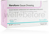 DermaRite Xeroform Gauze Dressing