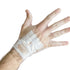 HydroSeal Wound Protector