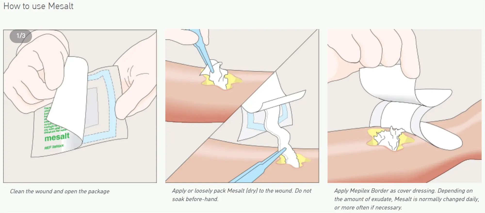 Mesalt Impregnated Dressing