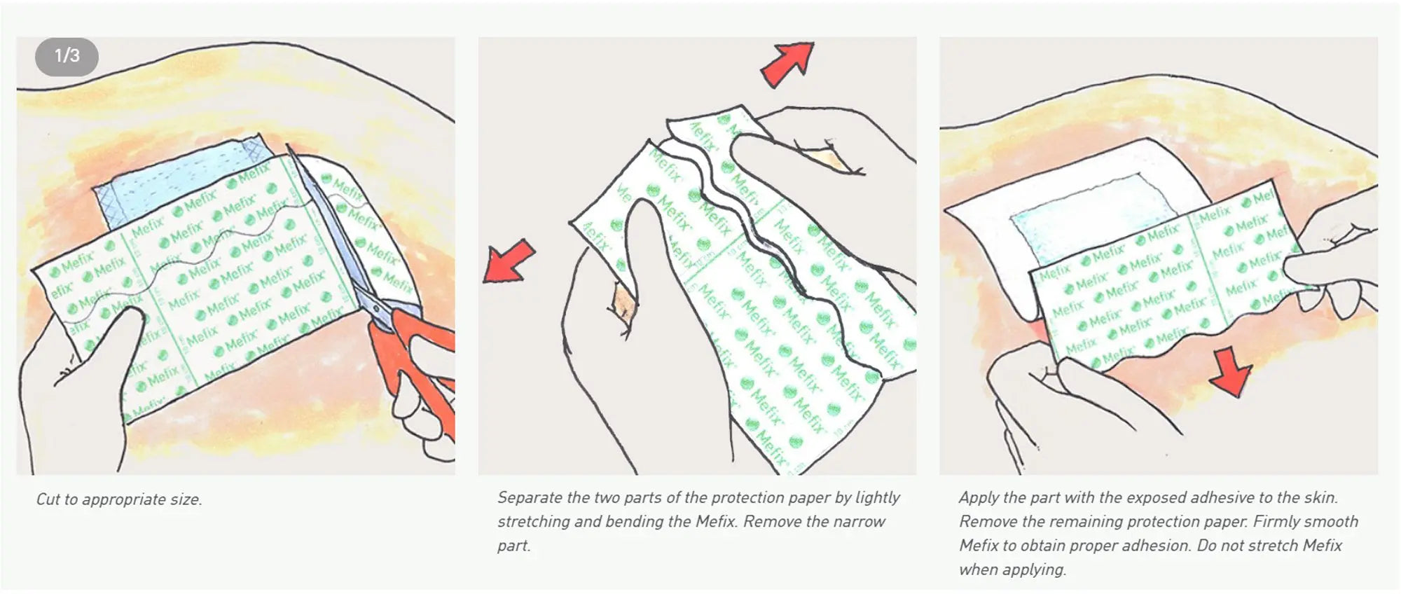 Molnlycke Mefix Self-Adhesive Fabric