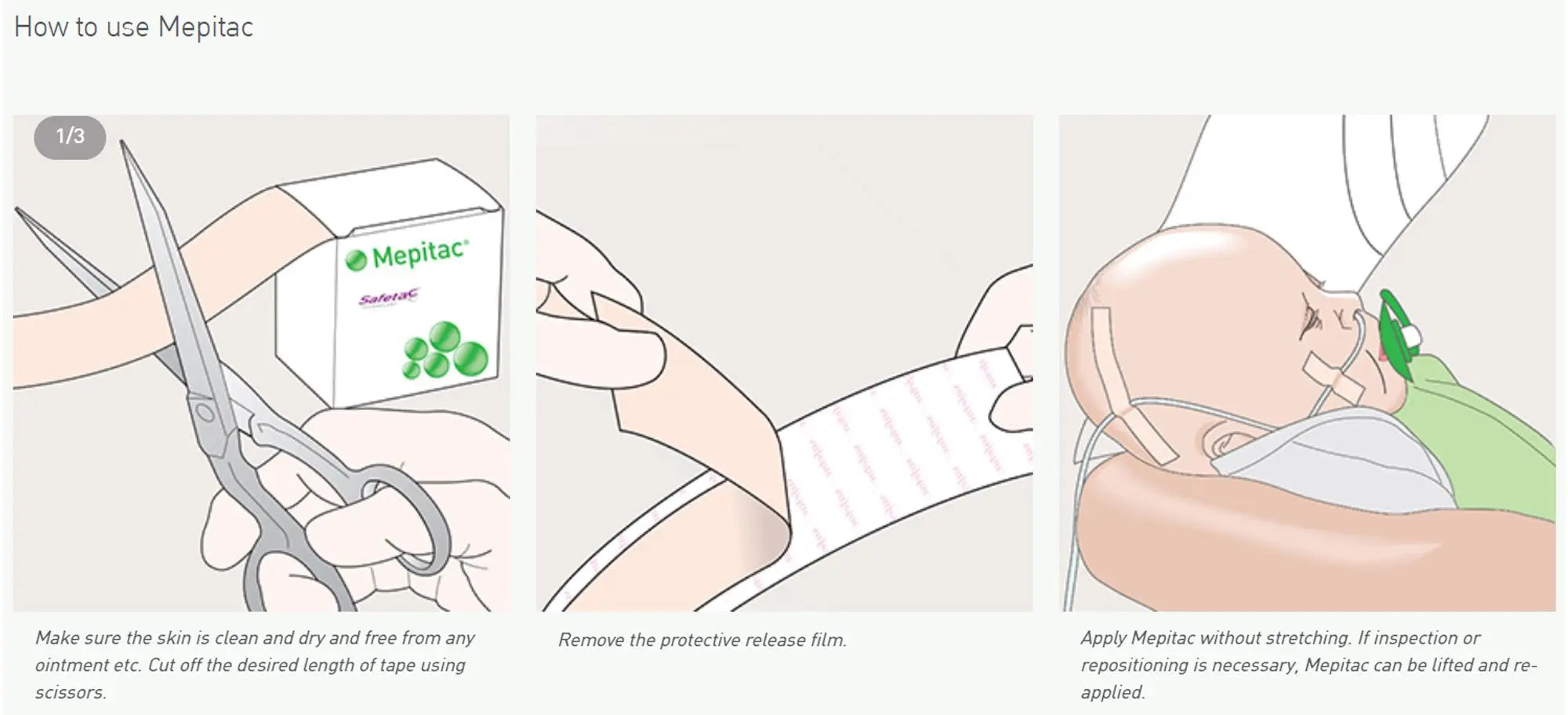 Molnlycke Mepitac Soft Silicone Tape