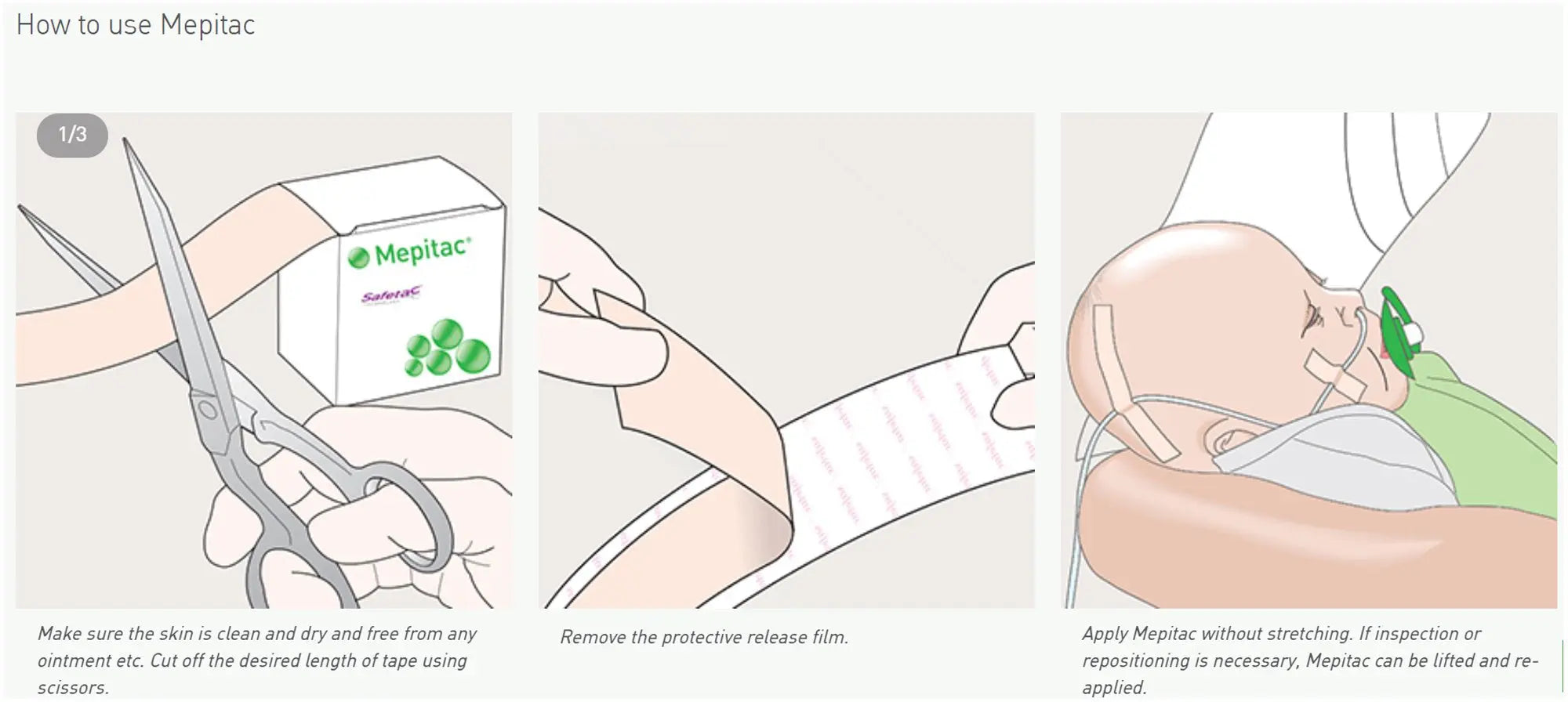 Molnlycke Mepitac Soft Silicone Tape