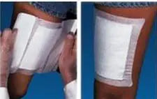 Stradis Medical Adhesive Dressing Gauze