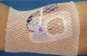 ProNet Elastic Net Retainer Dressing