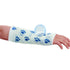Delta-Cast® Prints Cast Tape