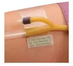 Dale Medical Hold-n-Place Foley Catheter Holder Adhesive Patch