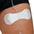 Tidi Products Grip-Lok Securement Device for Large Universal Catheter and Tubing, 6.5 in