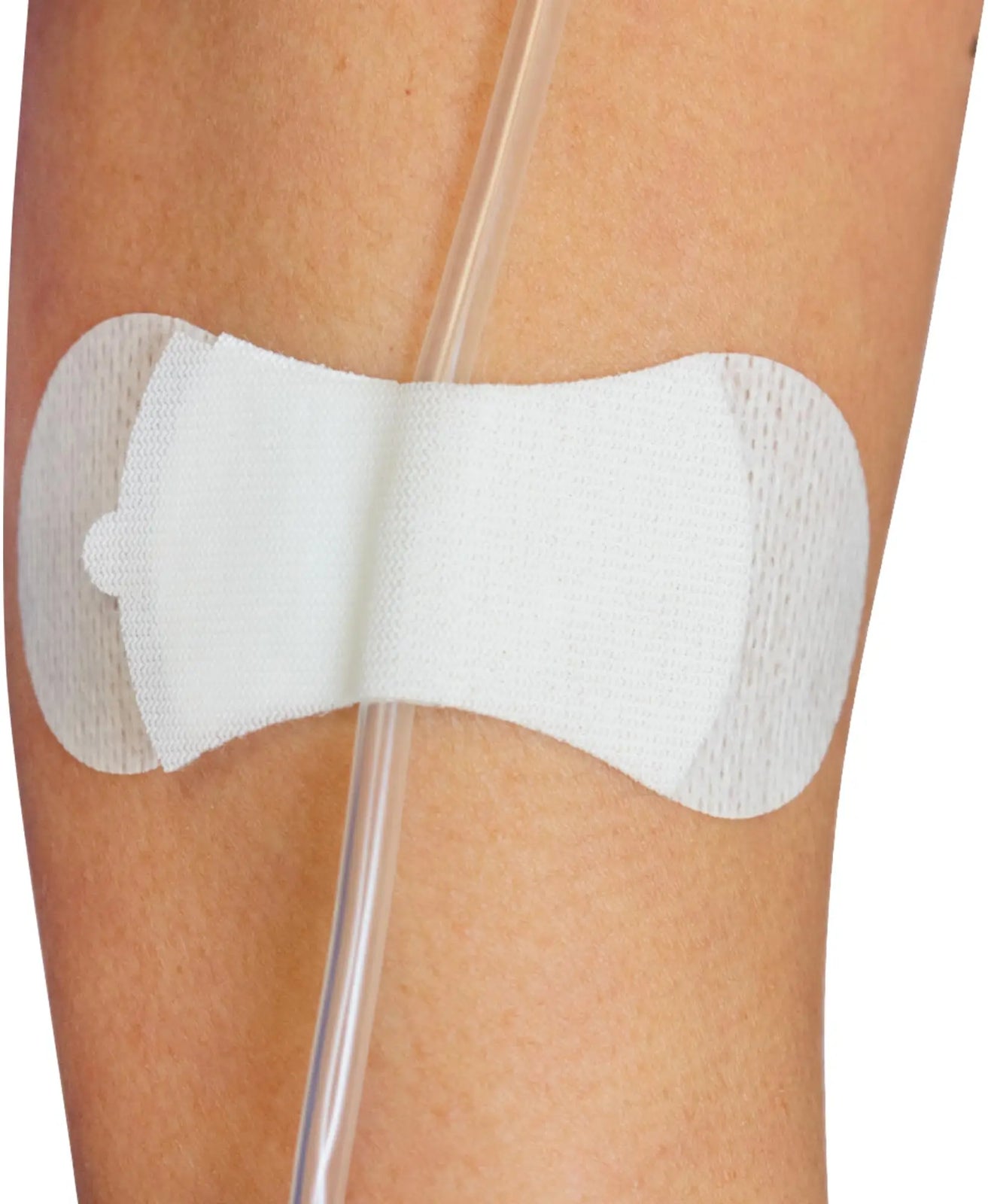 Tidi Products Securement Device for Medium Universal Catheter and Tubing, 3.5 in