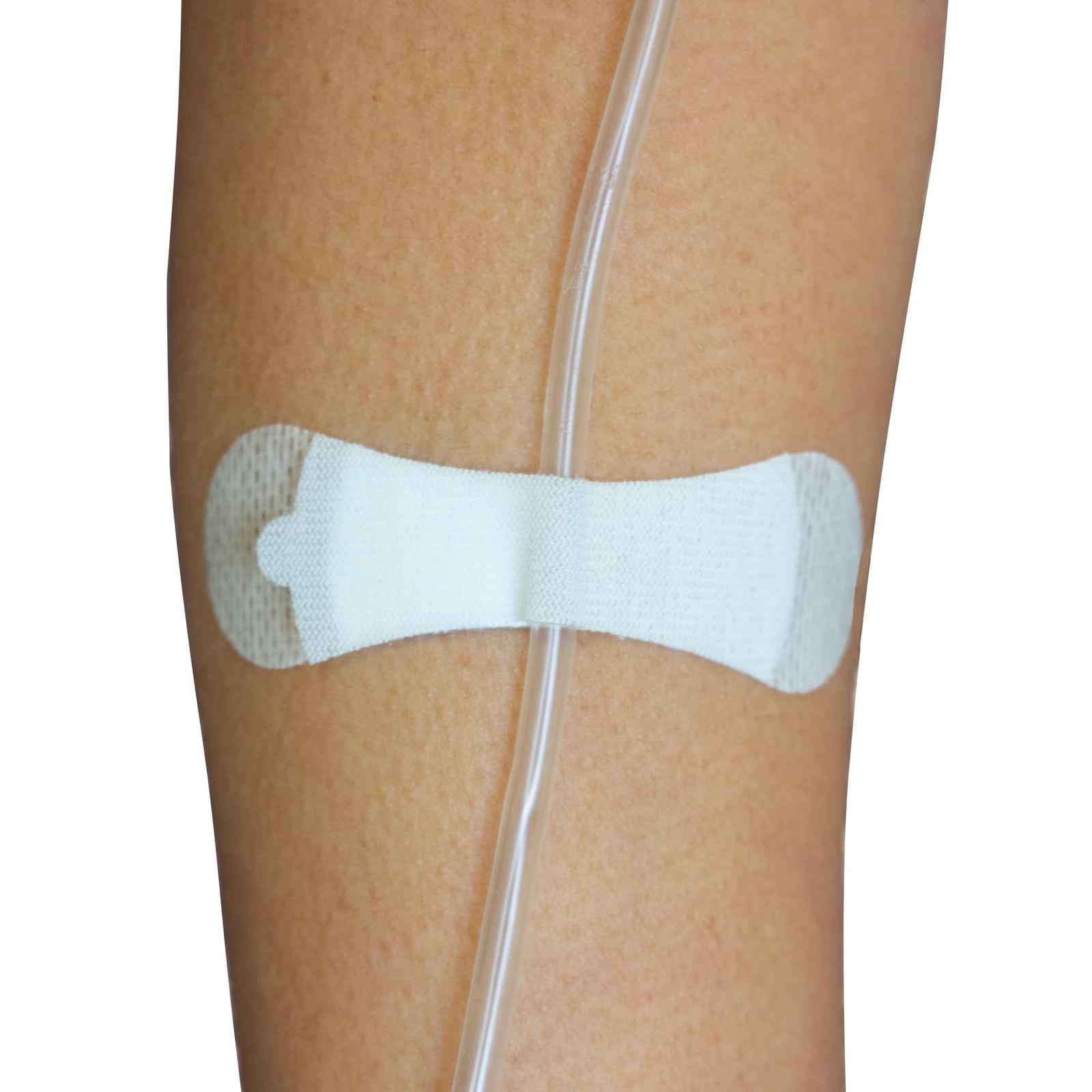 Tidi Products Grip-Lok Securement Device for Small Universal Catheter and Tubing, 3"