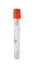 BD Vacutainer Venous Blood Collection Tube with ACD Solution B Additive