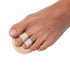Budin Toe Splint