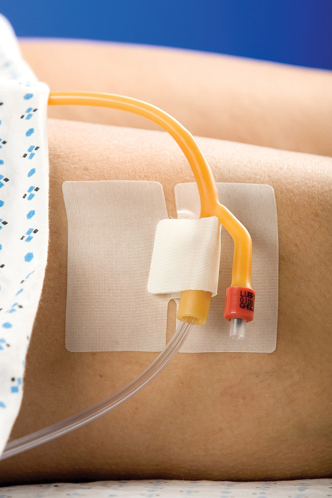 CATH-SECURE Multi-Purpose Tube Holder