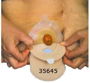Cymed Two Piece Closed Mini Ostomy Pouch with Flutter Valve