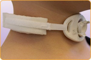MARPAC Collar-Holder Tracheostomy Tube Collar