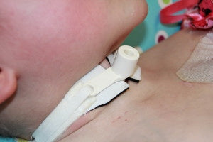 MARPAC Collar-Holder Tracheostomy Tube Collar