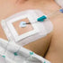 Sorbaview 2000 Window Dressing - Transparent Film Wound Care