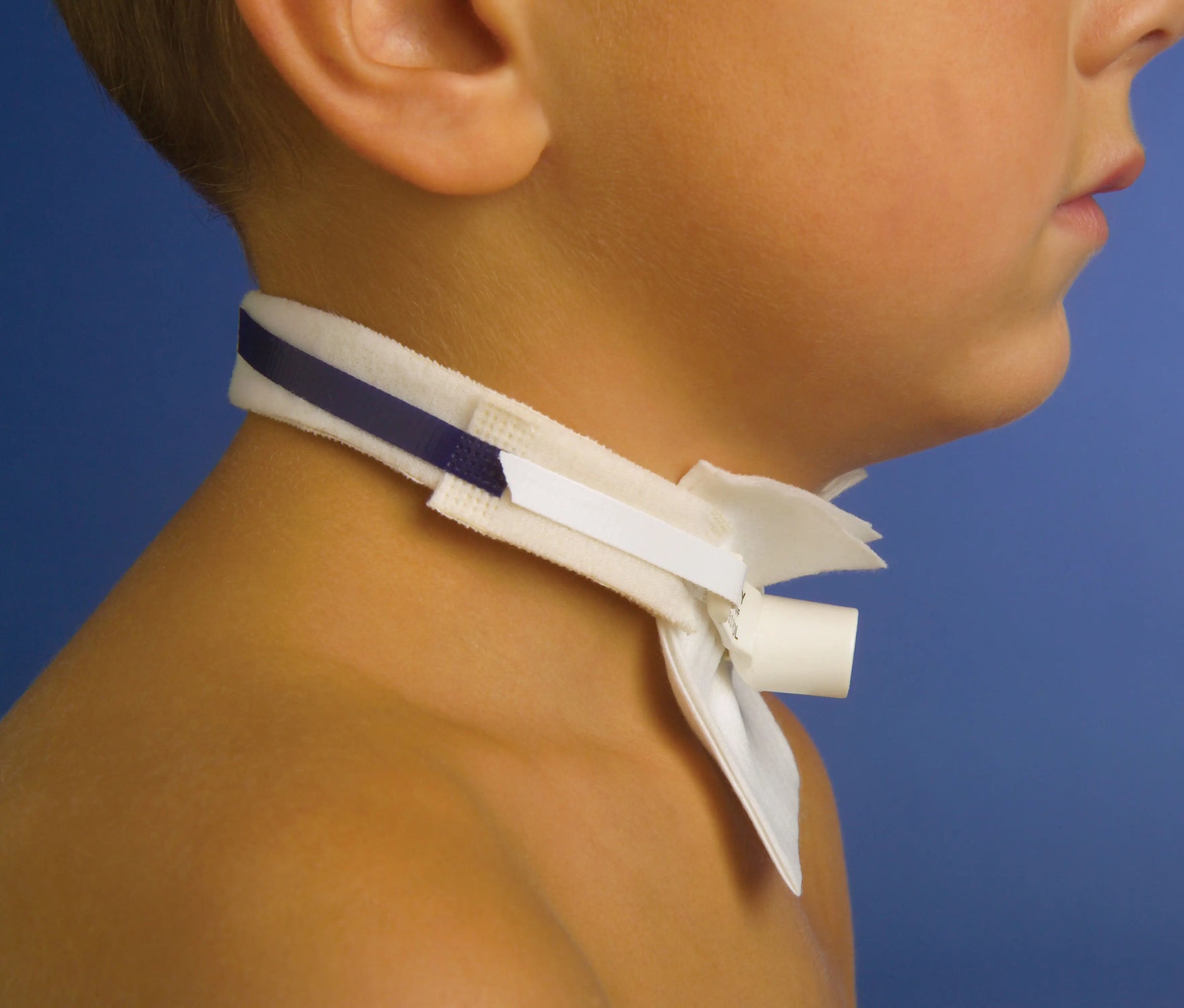 Pepper Medical Pedi-Tie II Tracheostomy Tube Holder