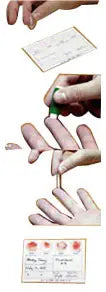 Smiths Medical Line Draw Aspirating Syringe with 23.5 IU/mL Advanced Formula Dry Lithium Heparin