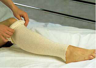 Albahealth Stockinette Tubular