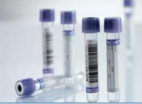 VACUETTE K3/K2 EDTA Blood Collection Tubes - 13x75/100mm, 2/3/6mL Lavender/Black/White PET