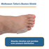 McKesson Tailor's Bunion Shield