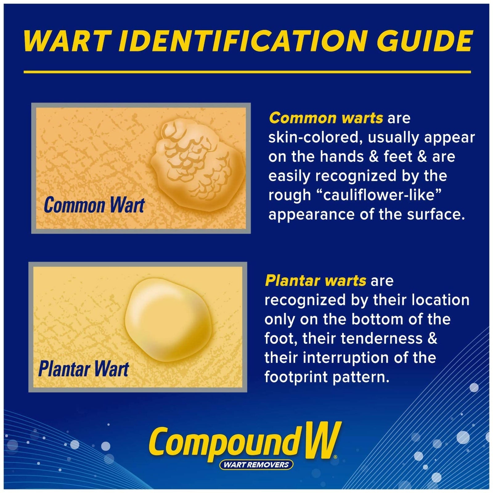 Compound W Freeze Off Wart Remover