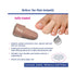 Visco-GEL Toe Protector Toe Protector