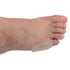 McKesson Tailor's Bunion Shield