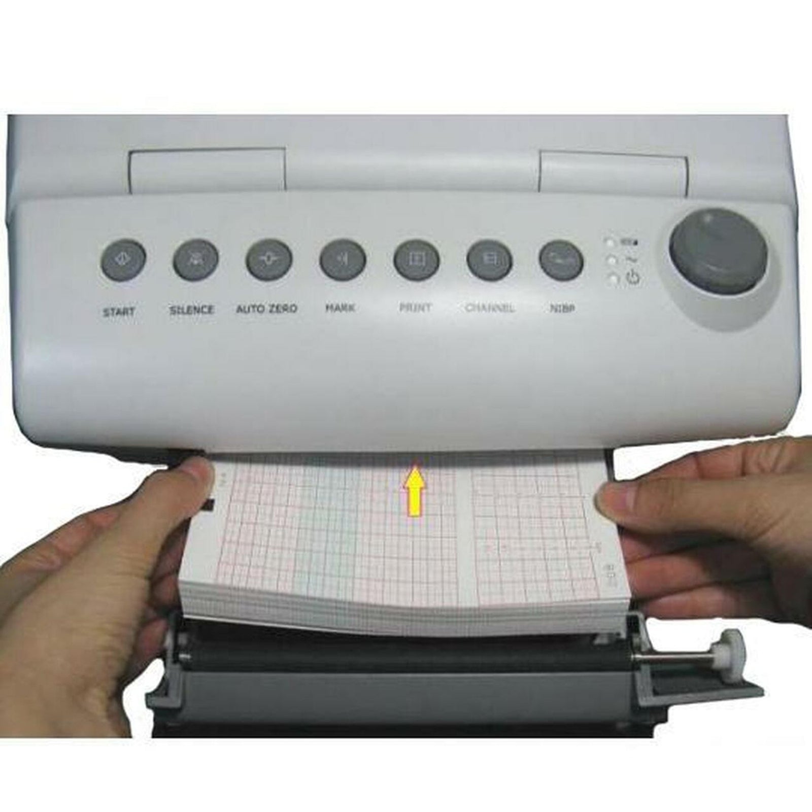 Edan Fetal Diagnostic Monitor Recording Paper