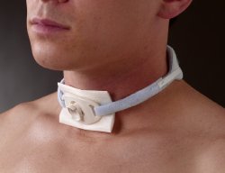 Trach Tie Tracheostomy Tube Holder