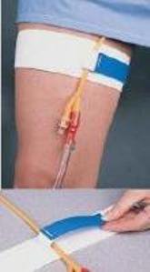 Cath-Mate  II Leg Stap